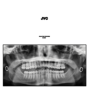 Album JVC